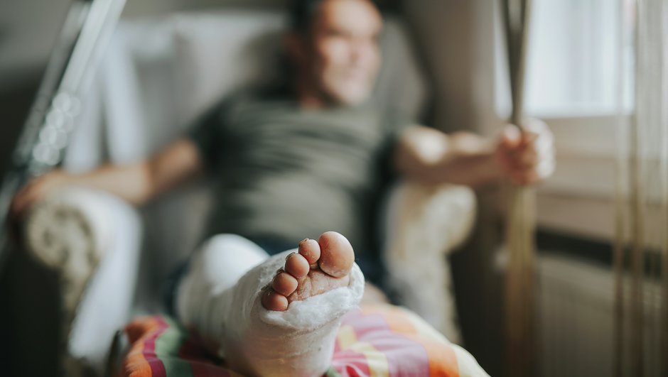 man having a cast in his leg.