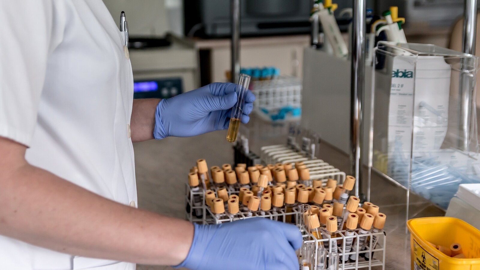 En kvinne holder på med forskjellige prøver på et laboratoriet